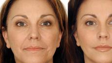 Mikrotokovna terapija obraza