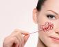 Практическо ръководство за използване на Nd:YAG лазери в козметологията